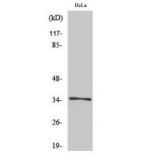 Anti-Olfactory receptor 52E6 antibody