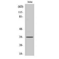 Anti-Olfactory receptor 4D1 antibody