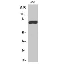 Anti-MPP9 antibody