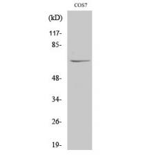 Anti-NUB1 antibody