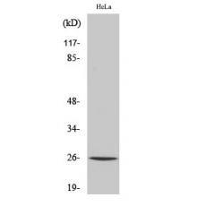 Anti-UMP-CMP Kinase antibody