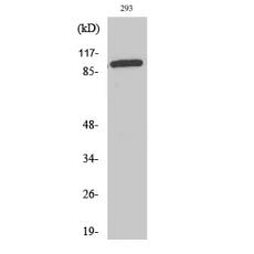 Anti-WBSCR11 antibody