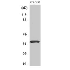 Anti-RASSF4 antibody