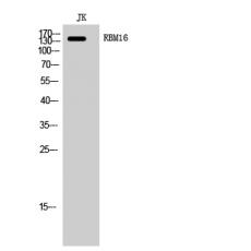 Anti-RBM16 antibody