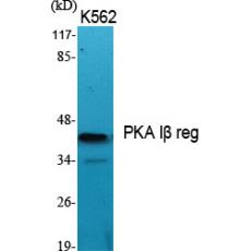Anti-PKA Iβ reg antibody