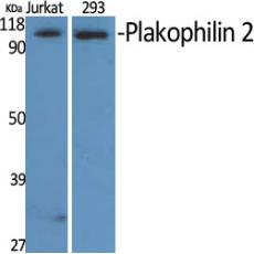 Anti-Plakophilin 2 antibody