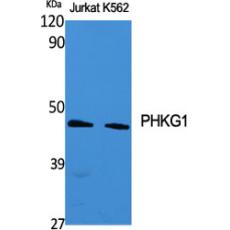 Anti-PHKG1 antibody