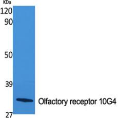 Anti-Olfactory receptor 10G4 antibody