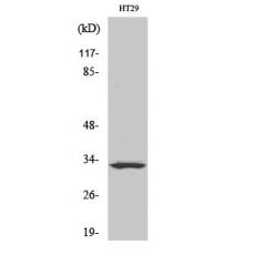 Anti-Olfactory receptor 2T1 antibody