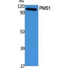 Anti-PMS1 antibody