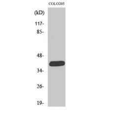 Anti-ORCTL2 antibody