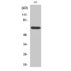 Anti-POTE14/22 antibody