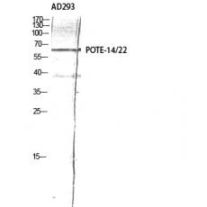 Anti-POTE-14/22 antibody
