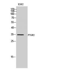 Anti-PTGR2 antibody