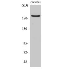 Anti-PDZ-RhoGEF antibody