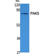 Anti-PAK5 antibody