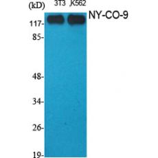 Anti-NY-CO-9 antibody