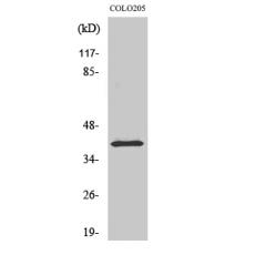 Anti-p53R2 antibody