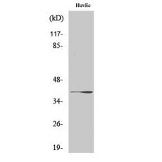 Anti-β-1,3-Gal-T1 antibody