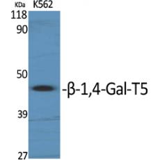 Anti-β-1,4-Gal-T5 antibody