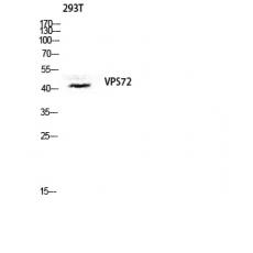 Anti-VPS72 antibody