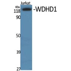 Anti-WDHD1 antibody