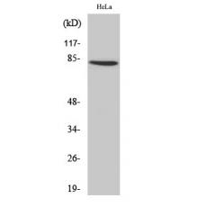 Anti-ZNF225 antibody