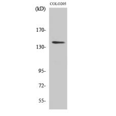 Anti-RGAG1 antibody