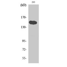 Anti-TAB182 antibody