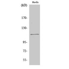 Anti-SENP3 antibody