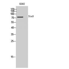 Anti-Six5 antibody