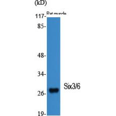 Anti-Six3/6 antibody