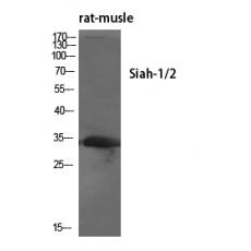 Anti-Siah-1/2 antibody