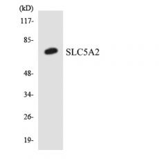 Anti-SGLT-2 antibody