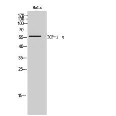 Anti-TCP-1 η antibody