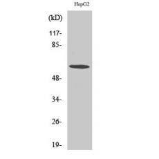 Anti-TCP-1 ζ antibody