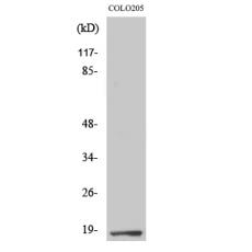 Anti-TCEAL1 antibody