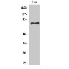 Anti-TBX2/3 antibody