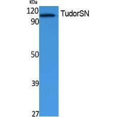 Anti-TudorSN antibody