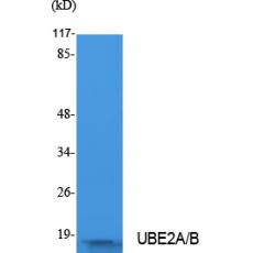 Anti-UBE2A/B antibody