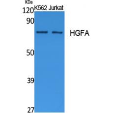 Anti-HGFA antibody