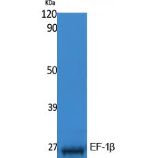 Anti-EF-1β antibody