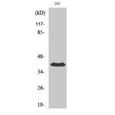 Anti-PP2Cκ antibody