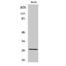 Anti-PP32R1 antibody