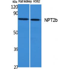 Anti-NPT2b antibody