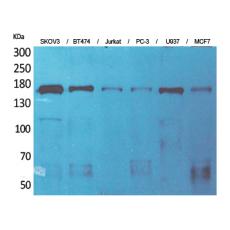 Anti-SCP-2 antibody