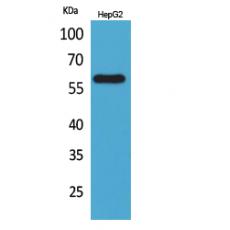 Anti-ASIC3 antibody