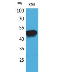 Anti-Kallistatin antibody