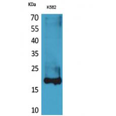 Anti-Lipocalin-1 antibody