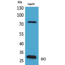 Anti-DCI antibody